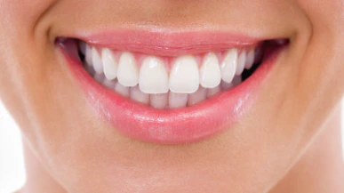 Sourire
