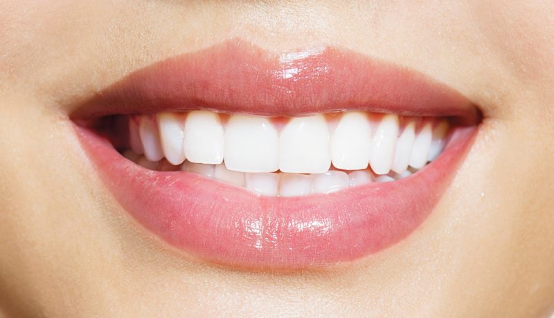 Tooth whitening