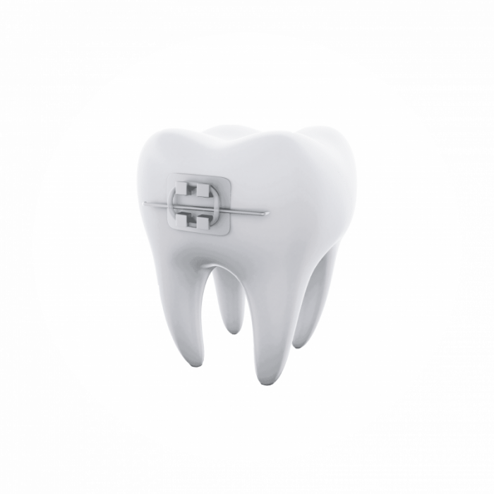 Les traitements d’orthodontie