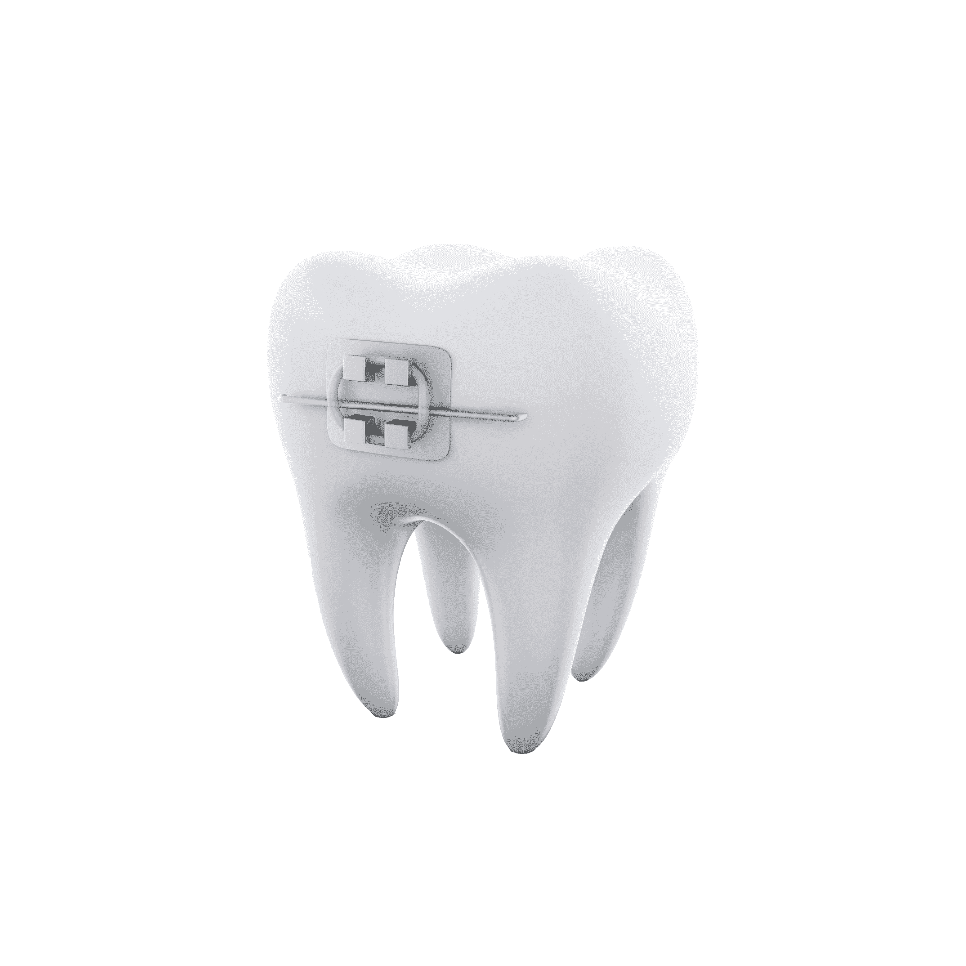 Orthodontic treatment