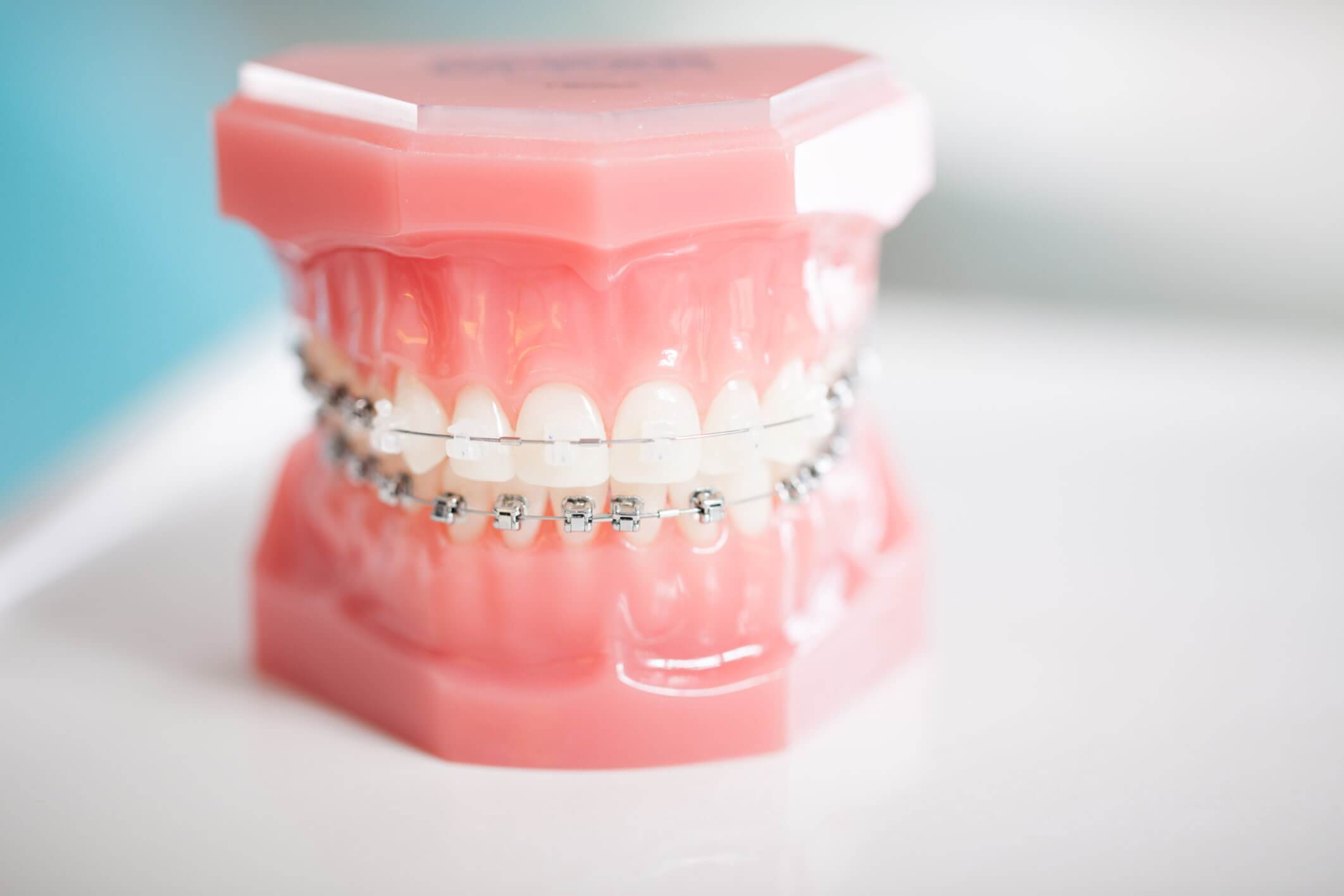 Service d'orthodontie à Laval