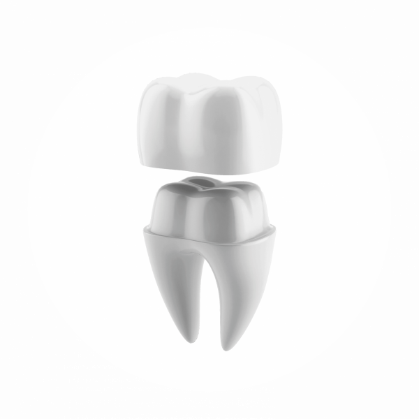 CEREC
